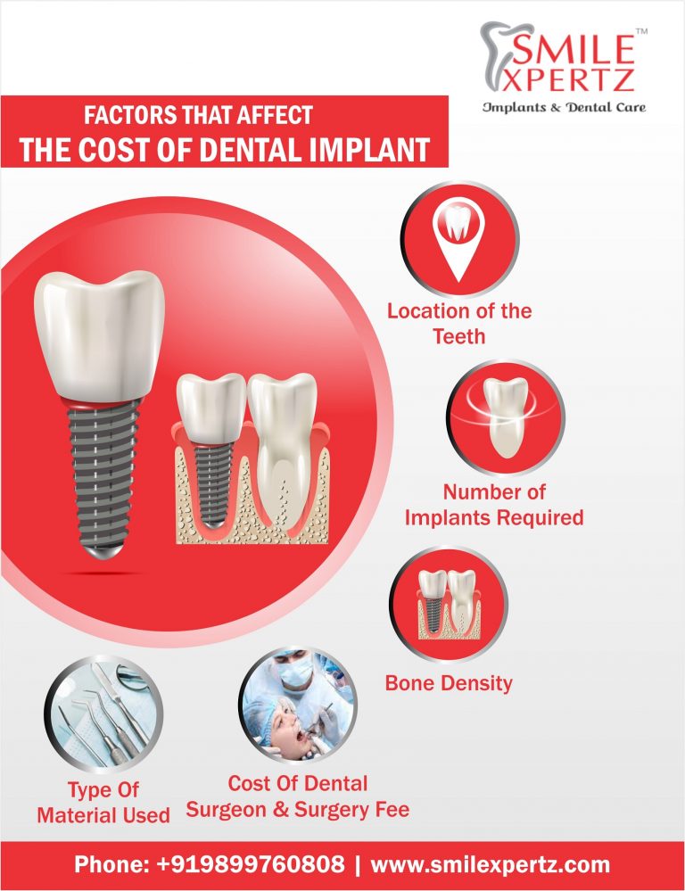 Dental Implant Cost in Gurgaon | Smile Xpertz